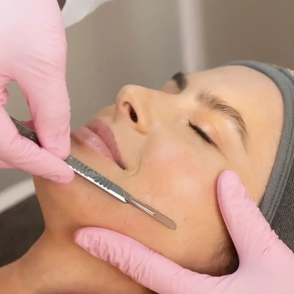 Person receiving dermaplaning facial treatment with scalpel by aesthetician wearing pink gloves.