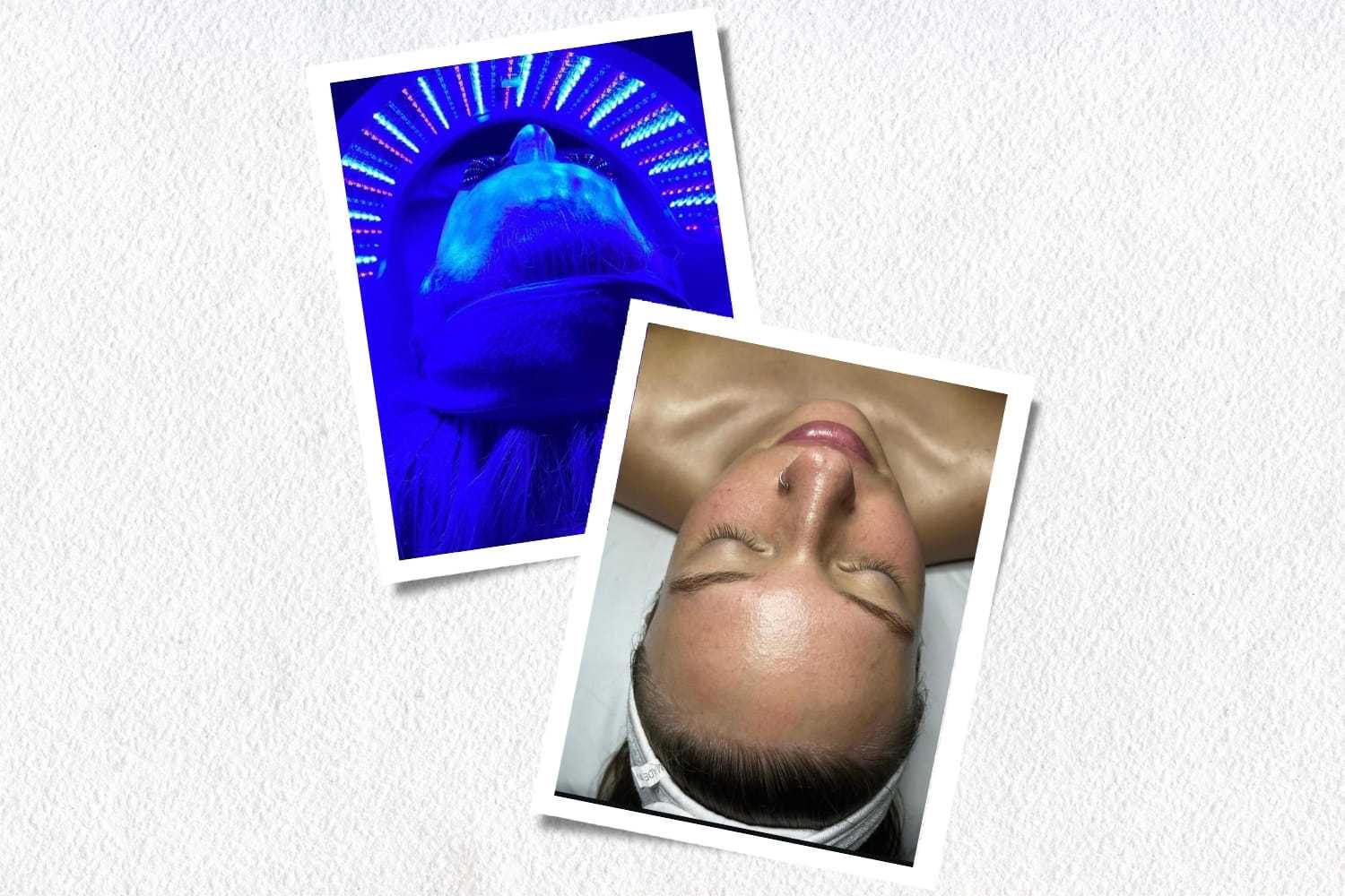 LED light therapy facial treatment side by side with before and after images.