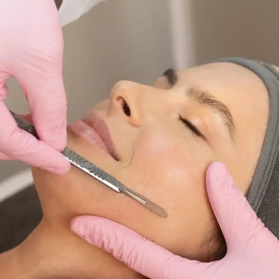 Person receiving dermaplaning facial treatment with scalpel by aesthetician wearing pink gloves.